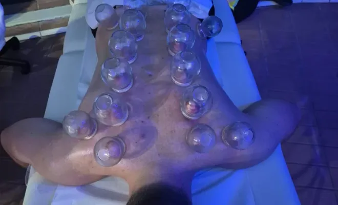 Séance cupping à Chambly, Clermont, Un Souffle Nouveau